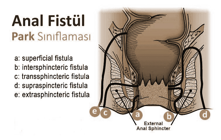 Anüs Fitül