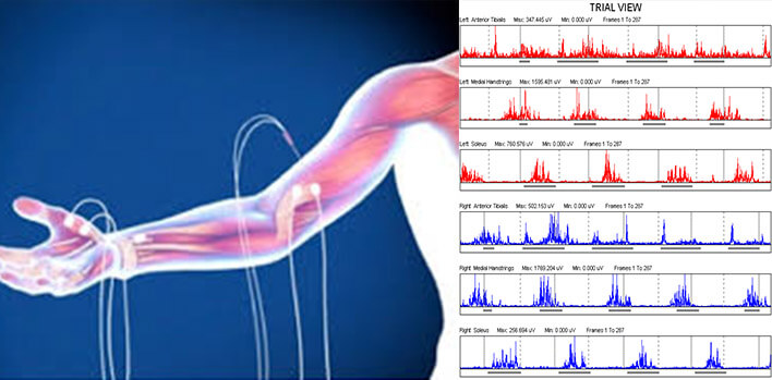 Emg Nedir Nasıl Yapılır