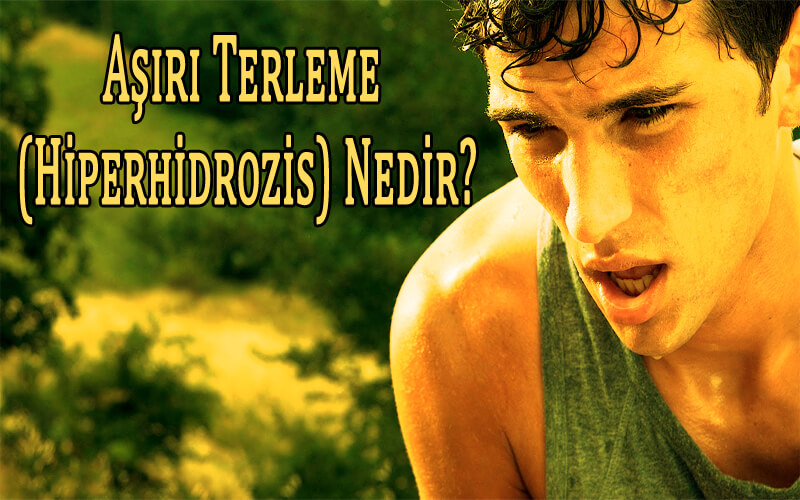 Aşırı Terleme (Hiperhidrozis) Nedir? Aşırı Terleme Nedenleri