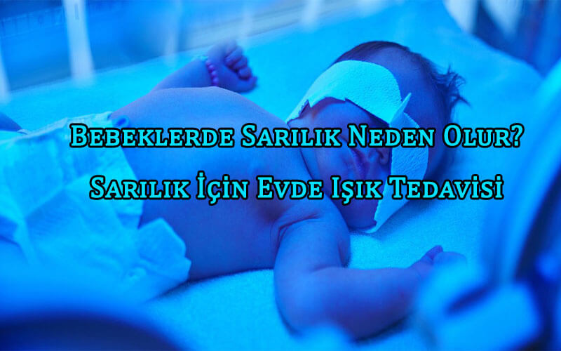 Bebeklerde Sarılık Neden Olur? Sarılık İçin Evde Işık Tedavisi