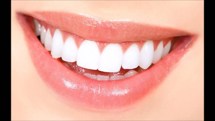 Diş Sararması ve Önüne Geçmek İçin Diş Sararması Tedavisi