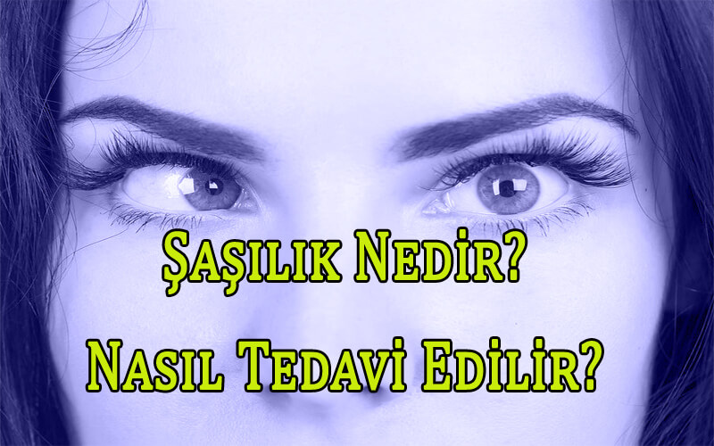 Şaşılık Nedir? Şaşılık Belirtileri ve Tedavisi