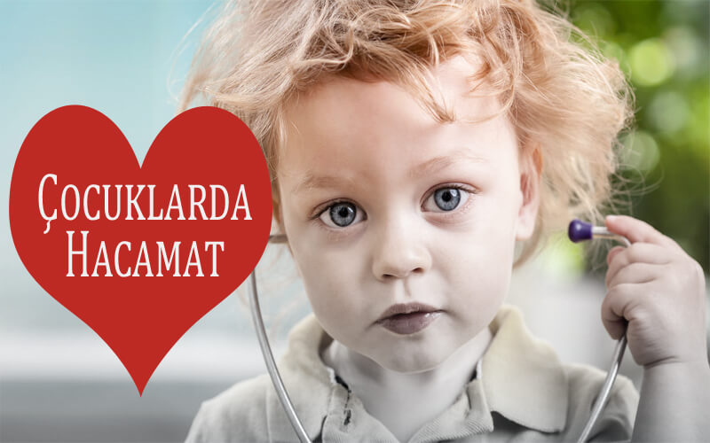 Çocuklarda Hacamat - Bebeklerde Hacamat Çocuklarda Hacamat - Bebeklerde Hacamat