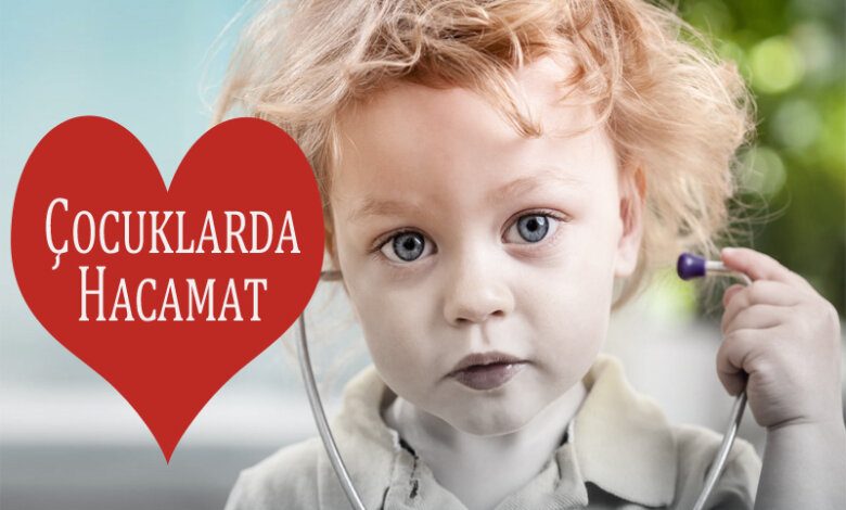 Çocuklarda Hacamat - Bebeklerde Hacamat